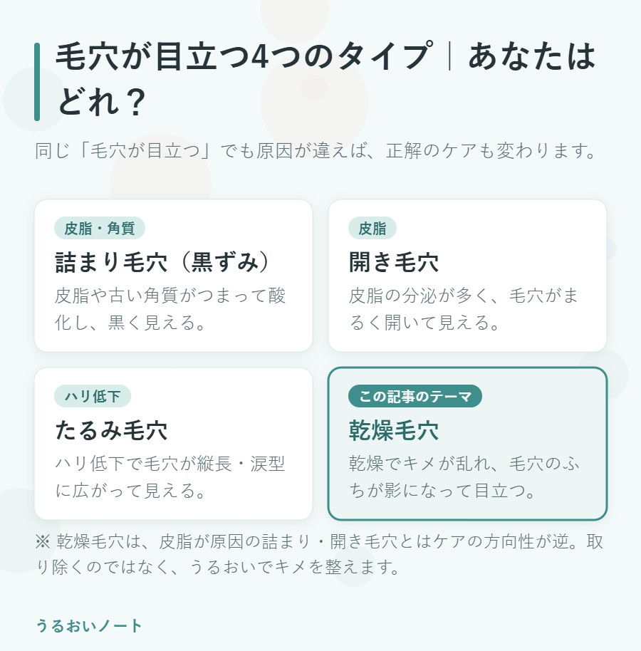 毛穴が目立つ4つのタイプの比較図。詰まり毛穴・開き毛穴・たるみ毛穴・乾燥毛穴の特徴を並べ、乾燥毛穴を強調
